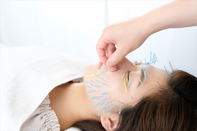 鍼灸施術で経絡を調整して症状を改善します